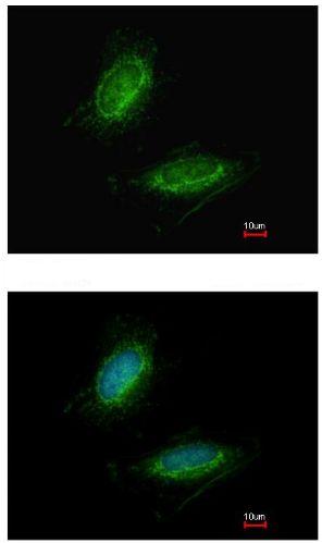 Immunocytochemistry/ Immunofluorescence - Anti-OPRT antibody (AB155763)