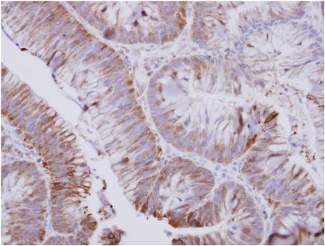 Immunohistochemistry (Formalin/PFA-fixed paraffin-embedded sections) - Anti-OPRT antibody (AB155763)