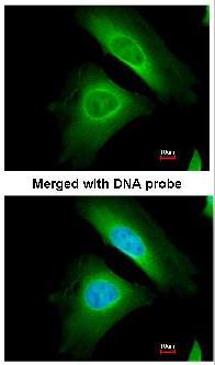 Immunocytochemistry/ Immunofluorescence - Anti-Optineurin antibody (AB151240)