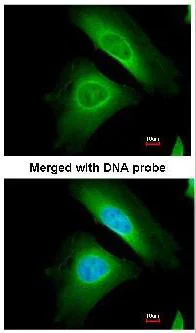 Immunocytochemistry/ Immunofluorescence - Anti-Optineurin antibody (AB151240)