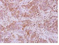 Immunohistochemistry (Formalin/PFA-fixed paraffin-embedded sections) - Anti-Optineurin antibody (AB151240)