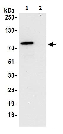 Immunoprecipitation - Anti-Optineurin antibody (AB264242)