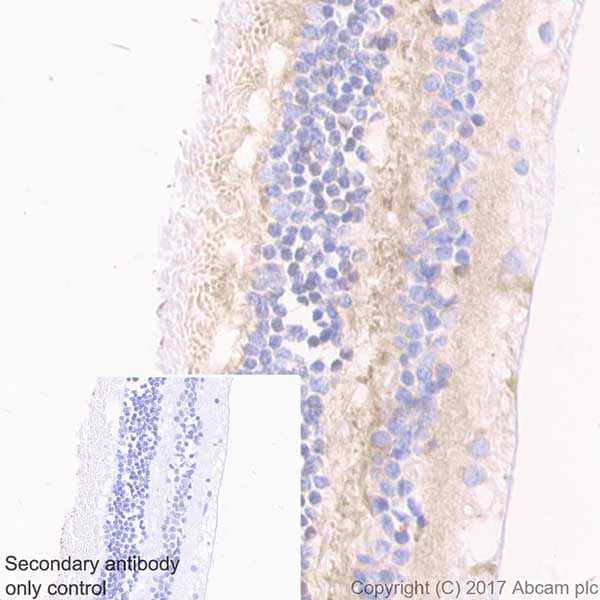 Immunohistochemistry (Formalin/PFA-fixed paraffin-embedded sections) - Anti-Optineurin antibody [EPR20654] (AB213556)