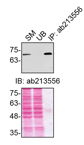 Immunoprecipitation - Anti-Optineurin antibody [EPR20654] (AB213556)