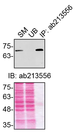 Immunoprecipitation - Anti-Optineurin antibody [EPR20654] - BSA and Azide free (AB240979)