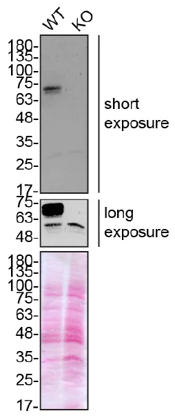 Western blot - Anti-Optineurin antibody [EPR20654] - BSA and Azide free (AB240979)