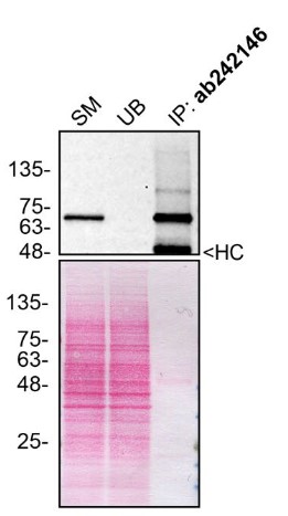 Immunoprecipitation - Anti-Optineurin antibody [EPR23059-124] (AB242146), expandable thumbnail