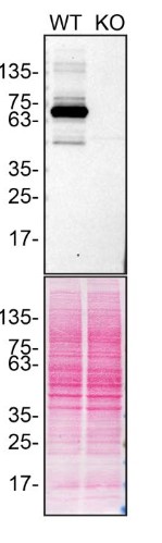 Western blot - Anti-Optineurin antibody [EPR23059-124] (ab242146), expandable thumbnail