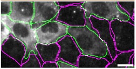 Immunocytochemistry/ Immunofluorescence - Anti-Optineurin antibody [EPR23059-124] - BSA and Azide free (AB264563)