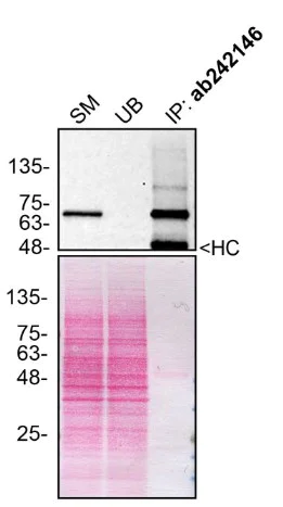 Immunoprecipitation - Anti-Optineurin antibody [EPR23059-124] - BSA and Azide free (AB264563)