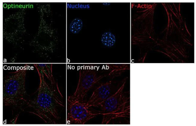 Immunocytochemistry/ Immunofluorescence - Anti-Optineurin Antibody [RP23040250] (AB313418)