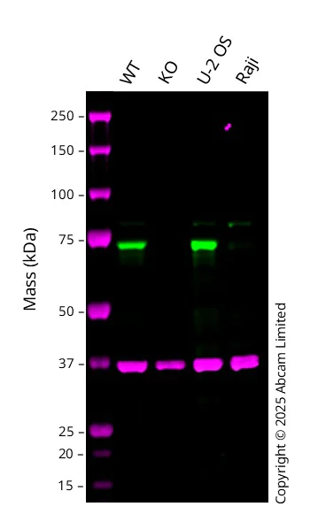 Western blot - Anti-Optineurin antibody [RP23040250] (AB313418)