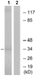 Western blot - Anti-OR10AD1 antibody (AB129895)