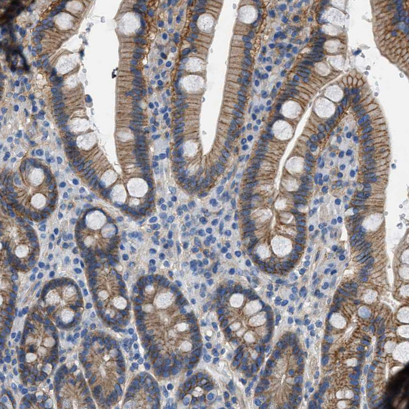 Immunohistochemistry (Formalin/PFA-fixed paraffin-embedded sections) - Anti-Orai1 antibody (AB244352), expandable thumbnail
