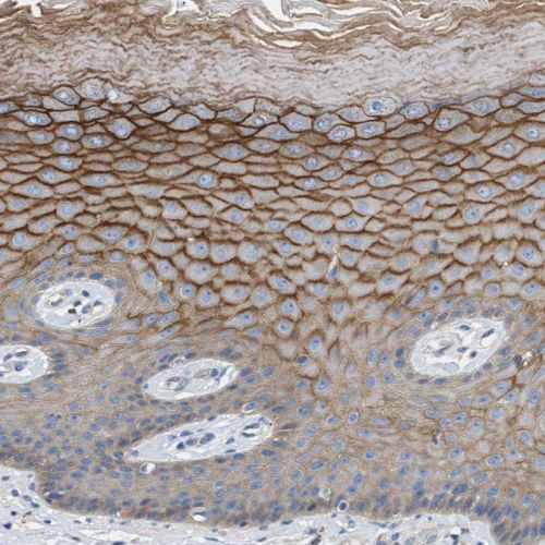 Immunohistochemistry (Formalin/PFA-fixed paraffin-embedded sections) - Anti-Orai1 antibody (AB244352), expandable thumbnail