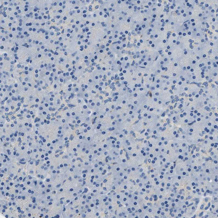 Immunohistochemistry (Formalin/PFA-fixed paraffin-embedded sections) - Anti-Orai1 antibody (AB244352)