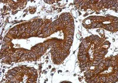 Immunohistochemistry (Formalin/PFA-fixed paraffin-embedded sections) - Anti-Orai2 antibody (AB155216)