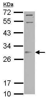 Western blot - Anti-Orai2 antibody (AB155216)
