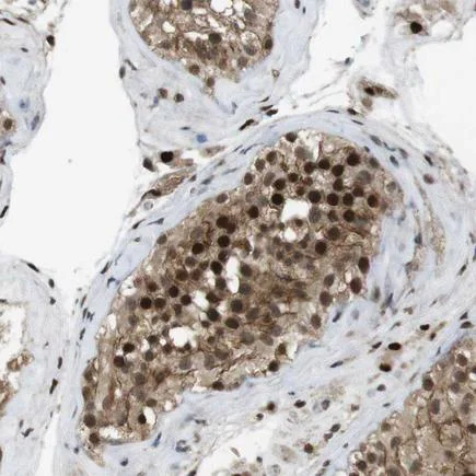 Immunohistochemistry (Formalin/PFA-fixed paraffin-embedded sections) - Anti-Orai3 antibody (AB224095)