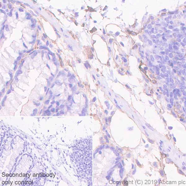 Immunohistochemistry (Formalin/PFA-fixed paraffin-embedded sections) - Anti-Orai3 antibody [EPR22575-17] - BSA and Azide free (AB255336)