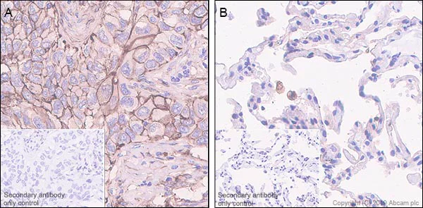 Immunohistochemistry (Formalin/PFA-fixed paraffin-embedded sections) - Anti-Orai3 antibody [EPR22575-17] - BSA and Azide free (AB255336)