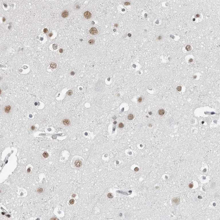 Immunohistochemistry (Formalin/PFA-fixed paraffin-embedded sections) - Anti-ORC1 antibody (AB251776)
