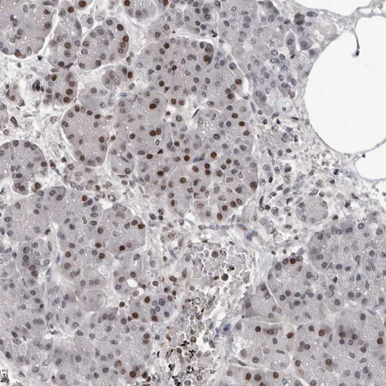 Immunohistochemistry (Formalin/PFA-fixed paraffin-embedded sections) - Anti-ORC1 antibody (AB251776)