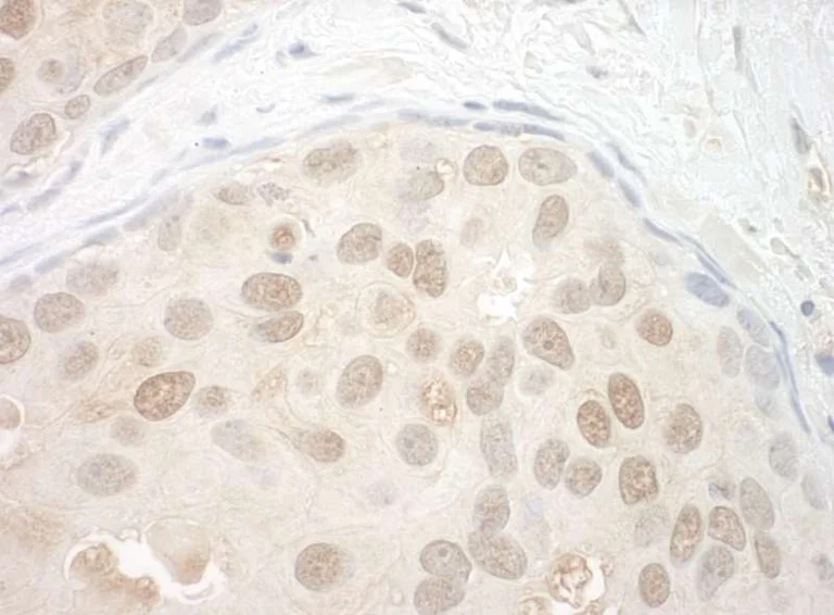 Immunohistochemistry (Formalin/PFA-fixed paraffin-embedded sections) - Anti-ORC2 antibody (AB264304)