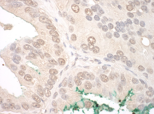 Immunohistochemistry (Formalin/PFA-fixed paraffin-embedded sections) - Anti-ORC2 antibody (AB99277)
