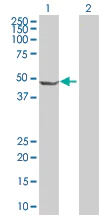 Western blot - ORC4L overexpression 293T lysate (whole cell) (AB94143)