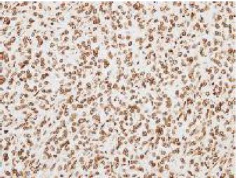 Immunohistochemistry (Formalin/PFA-fixed paraffin-embedded sections) - Anti-ORC6 antibody - C-terminal (AB153993), expandable thumbnail