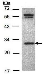 Western blot - Anti-ORC6 antibody - C-terminal (AB153993), expandable thumbnail