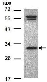 Western blot - Anti-ORC6 antibody - C-terminal (AB153993)