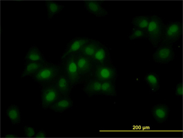 Immunocytochemistry/ Immunofluorescence - Anti-ORC6L antibody (AB88686), expandable thumbnail