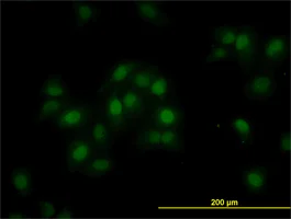 Immunocytochemistry/ Immunofluorescence - Anti-ORC6L antibody (AB88686)