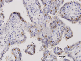 Immunohistochemistry (Formalin/PFA-fixed paraffin-embedded sections) - Anti-ORC6L antibody (AB88686), expandable thumbnail