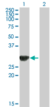 Western blot - Anti-ORC6L antibody (AB88686), expandable thumbnail