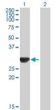 Western blot - Anti-ORC6L antibody (AB88686)