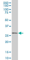 Western blot - Anti-ORC6L antibody (AB88686), expandable thumbnail