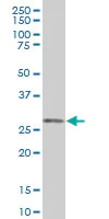 Western blot - Anti-ORC6L antibody (AB88686)