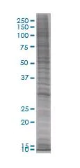 SDS-PAGE - ORC6L overexpression 293T lysate (whole cell) (AB94161)