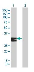 Western blot - ORC6L overexpression 293T lysate (whole cell) (AB94161)