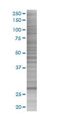 ORC6L overexpression 293T lysate (whole cell)