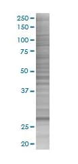 SDS-PAGE - ORC6L overexpression 293T lysate (whole cell) (AB94162)
