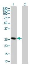 Western blot - ORC6L overexpression 293T lysate (whole cell) (AB94162)