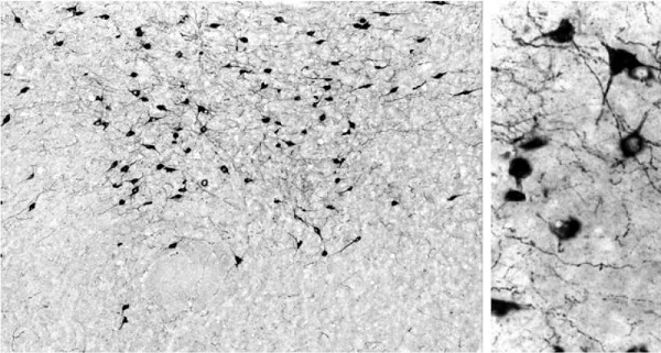 Immunohistochemistry (Formalin/PFA-fixed paraffin-embedded sections) - Anti-Orexin A antibody (AB6214)