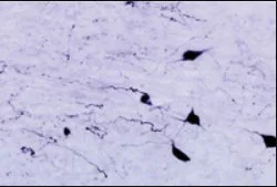 Immunohistochemistry (Formalin/PFA-fixed paraffin-embedded sections) - Anti-Orexin A antibody (AB6214)