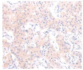 Immunohistochemistry (Formalin/PFA-fixed paraffin-embedded sections) - Anti-Orexin antibody (AB199275)