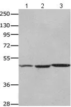Western blot - Anti-Orexin Receptor 2 antibody (AB183072)