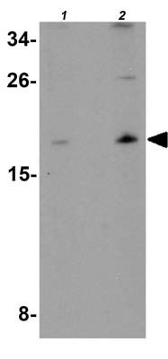 Western blot - Anti-ORMDL1 antibody (AB176122), expandable thumbnail